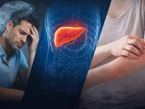 5 dấu hiệu cơ thể tưởng bình thường nhưng có thể K đã tấn công