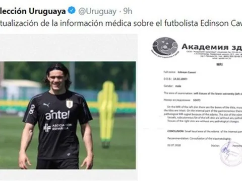 Bình phục chấn thương, Cavani sẵn sàng ra sân ở trận đấu với Pháp?