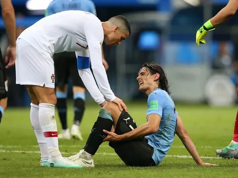 Cavani đi khập khiễng, dễ nghỉ đá trận gặp Pháp