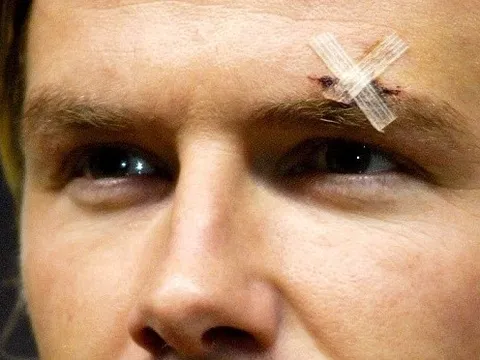Chiếc giày bay và "vết sẹo" cuộc đời David Beckham