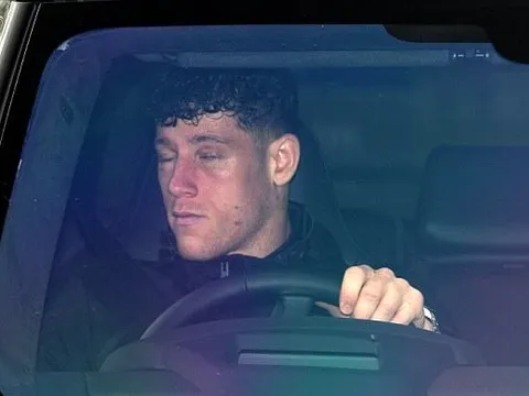 Chùm ảnh: Ross Barkley bị đánh sưng húp, bầm tím mắt