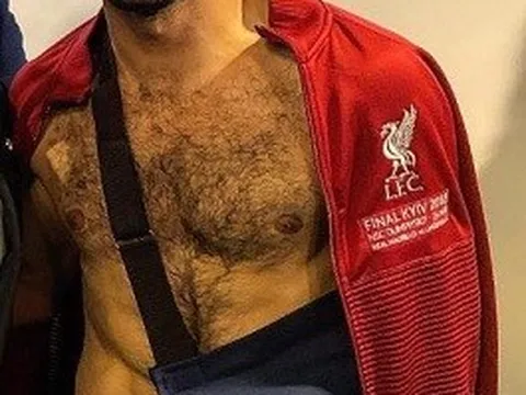 NÓNG: Chấn thương của Salah không nghiêm trọng