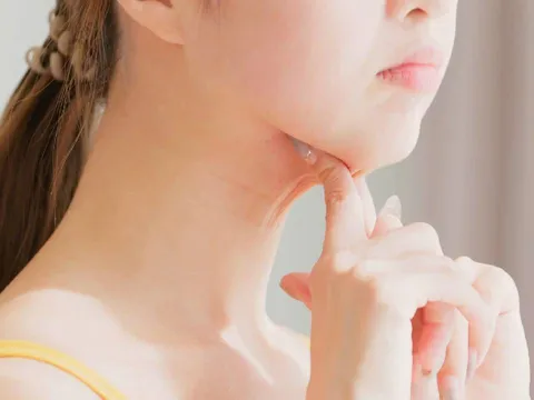 Mẹo ăn uống giúp giảm béo mặt, giảm nọng cằm