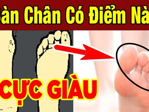 Người có tướng bàn chân này cả đời đi trên nhung lụa: Đó là bàn chân nào?