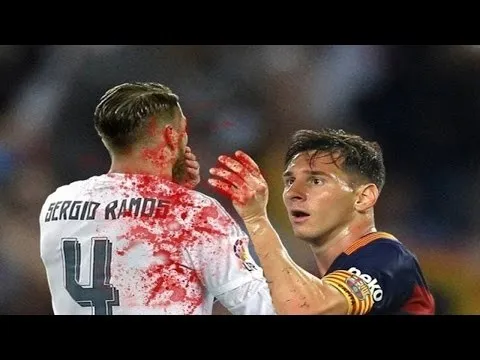 Những tình huống xấu xí ở El Clasico