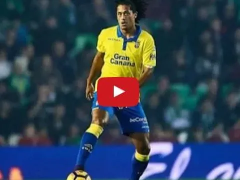 Tài năng đặc biệt của Mauricio Lemos (Las Palmas)