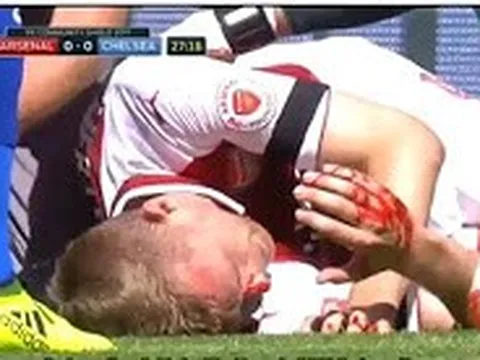 Tình huống khiến Mertesacker đổ máu