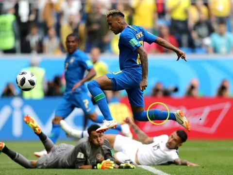 Vì sao Neymar xung trận với chiếc tất rách?