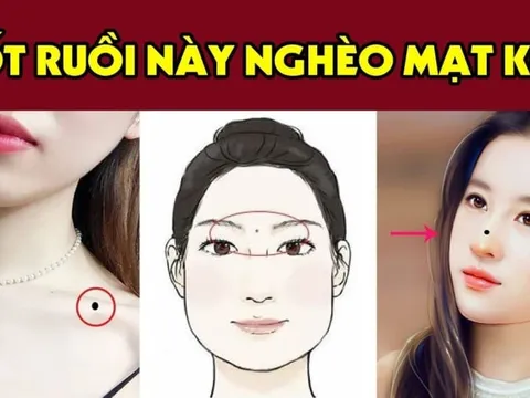 3 nốt ruồi lận đận nên tìm cách hóa giải kẻo về già cô độc