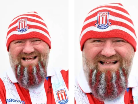 CĐV Stoke độ râu khủng để chào đón Chelsea