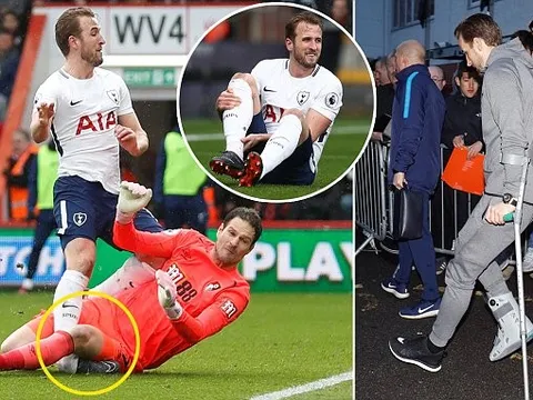 Đứt dây chằng, Harry Kane nguy cơ lỡ World Cup