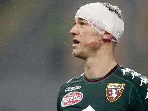 Joe Hart đổ máu vì bị gầm giày cào lên đầu