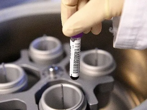 Nga bị loại khỏi World Cup 2018 vì doping?