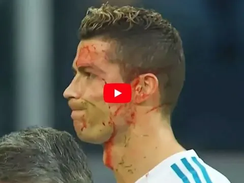 Những lần bị phạm lỗi thô bạo của Cristiano Ronaldo