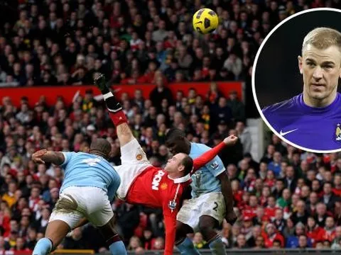 Những lần Joe Hart làm nền cho siêu phẩm