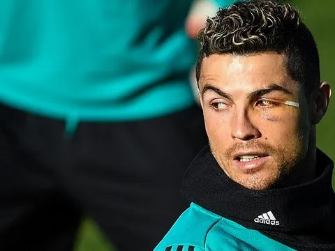 Ronaldo tập sung dù mắt sưng húp, quyết cứu nguy Real Madrid