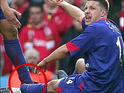 Tai nạn chấn thương kinh hoàng của Alan Smith vs Liverpool