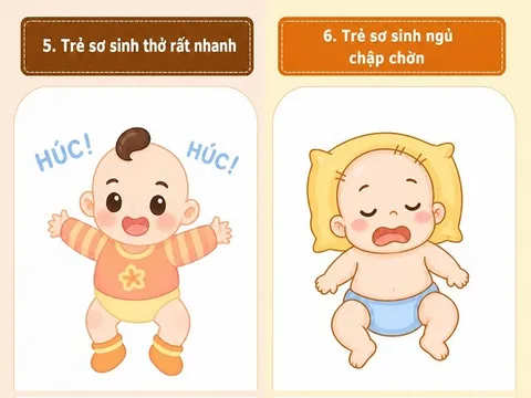 10 hiện tượng "kỳ lạ" ở trẻ sơ sinh, số 3 khiến nhiều bố mẹ hoang mang nhất