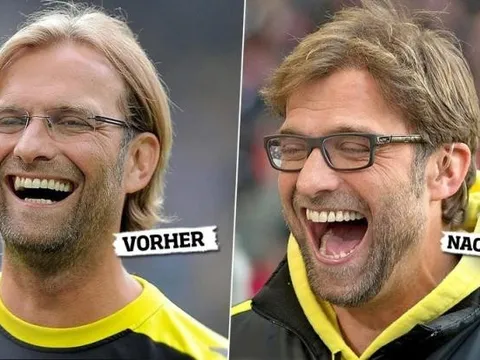 10 bí mật chưa được bật mí về Klopp