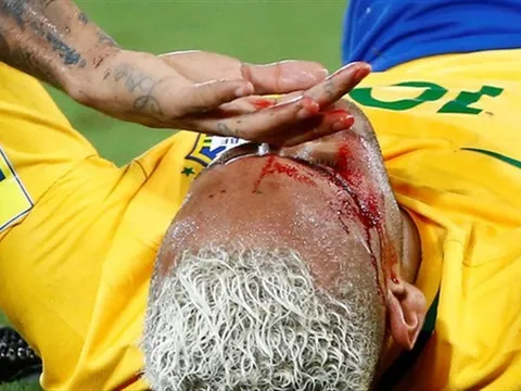 Chùm ảnh: Neymar chảy máu lênh láng trong chiến thắng '5 sao' của Brazil