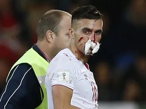 Đổ máu mũi, cầu thủ Serbia vẫn chơi hết trận