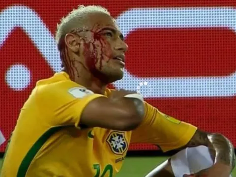 'Gạt tay' làm Neymar đổ máu, Duk còn muốn được tôn trọng