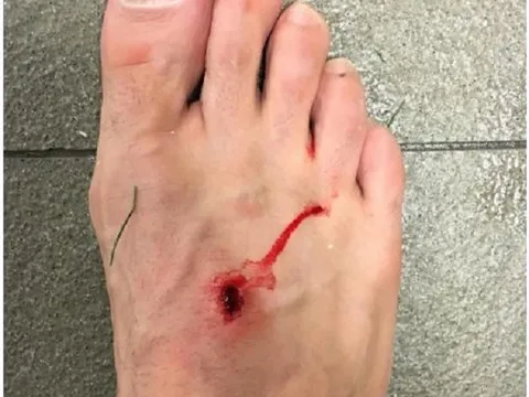 Suarez đáp trả Filipe Luis sau màn công kích trên MXH