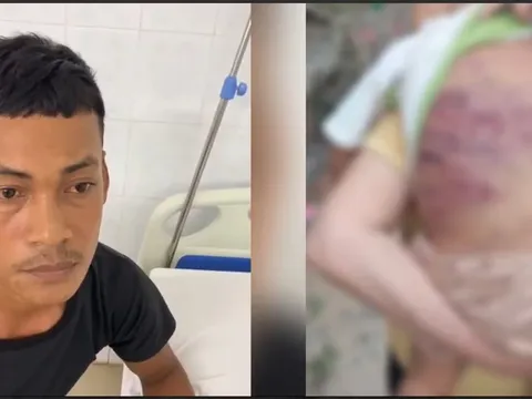 Hé lộ lời khai rợn người của cha dượng trong vụ bé trai 2 tuổi bị bạo hành đến nguy kịch