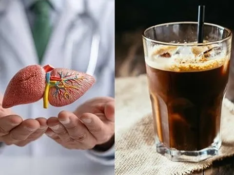 5 cách uống cà phê đốt mỡ, khoẻ người