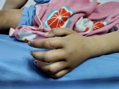 Hà Nội: Bé gái 4 tuổi tử vong sau khi bị cha dượng và mẹ ruột bạo hành trong phòng trọ