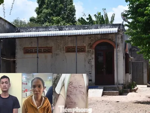 Hé lộ nhân thân mẹ ruột và người tình trong vụ bé trai 2 tuổi bị bạo hành gây phẫn nộ