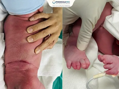 Phép màu từ tình mẹ: Người mẹ vượt hàng ngàn cây số để tìm cơ hội sống cho con