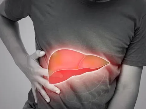 6 dấu hiệu cảnh báo suy gan thường xuất hiện vào buổi tối