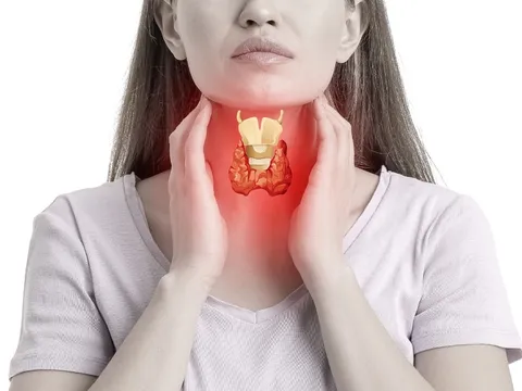 8 dấu hiệu cảnh báo ung thư tuyến giáp sớm nhất bạn không nên bỏ qua