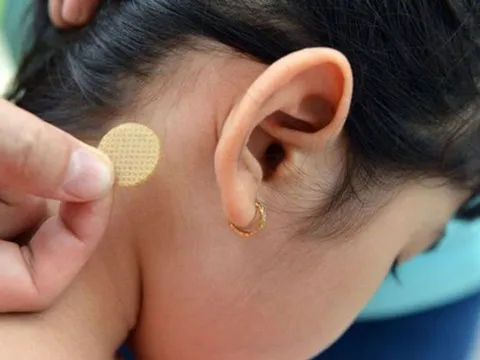 Bé gái 7 tuổi bị rối loạn hành vi, nói nhảm suốt đêm vì tác dụng phụ của miếng dán chống say tàu xe
