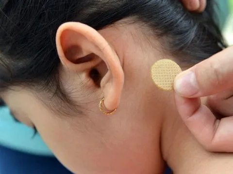 Từ vụ bé gái 7 tuổi thức trắng đêm, nói nhảm sau khi dán miếng chống say xe: Bố mẹ cần lưu ý gì khi sử dụng?