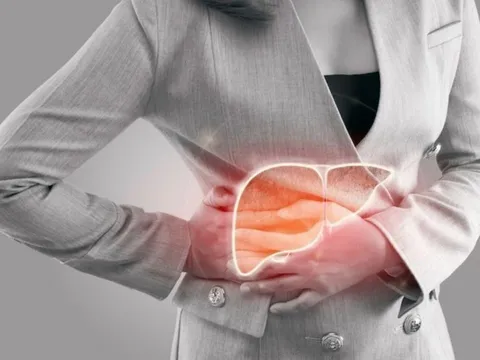 6 dấu hiệu bất thường cảnh báo bệnh suy gan đang tiến triển nhanh, nhiều người chủ quan