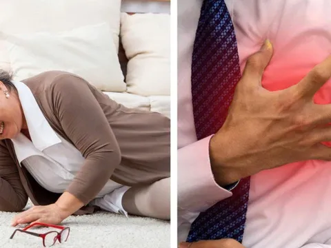 5 dấu hiệu cho thấy bạn thuộc nhóm dễ bị đột quỵ: Nhiều người có mà không biết