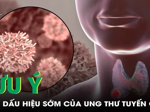 5 dấu hiệu K tuyến giáp mới chớp: Biết sớm chữa là khỏi