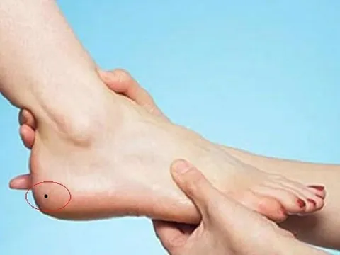 4 nốt ruồi trên bàn chân mang lại may mắn: Đừng dại xóa đi