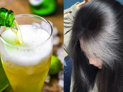 Cách gội đầu bằng bia giúp sạch gàu, mượt tóc, tóc con mọc ầm ầm