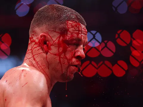 Nate Diaz lên tiếng sau thất bại đẫm máu trước Mike Perry: 'Giờ là lúc bắt đầu cuộc đi săn'
