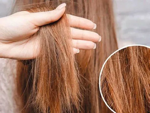 5 cách phục hồi tóc cháy nắng giúp tóc mềm hơn, giảm khô xơ trong mùa hè