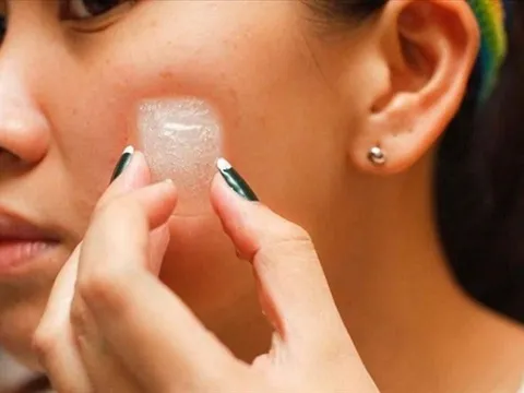 Cách dùng đá lạnh giúp se khít lỗ chân lông, da mịn màng trắng sáng