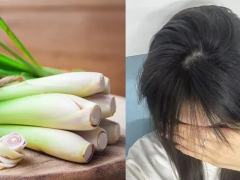 Cách gội đầu bằng sả giúp sạch gàu, tóc lâu bết, tóc con đua nhau mọc