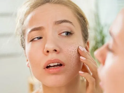 Dưỡng ẩm quá mức có thể khiến da “quá tải”