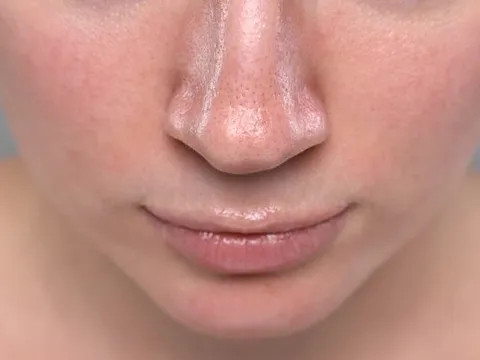 3 sai lầm chăm da mùa hè khiến da dễ đổ dầu, nổi mụn và nhanh lão hóa