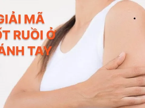 4 nốt ruồi trên cánh tay mang tới may mắn cho bạn: Đừng dại xóa đi