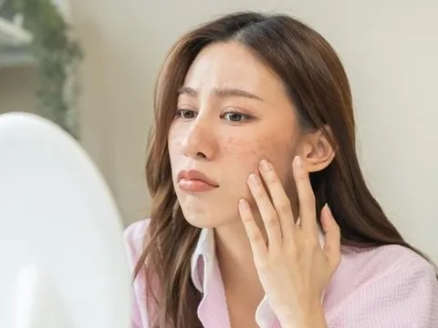 3 sai lầm chăm sóc da nhiều người mắc phải vào mùa hè khiến da đổ dầu, nổi mụn và nhanh lão hóa