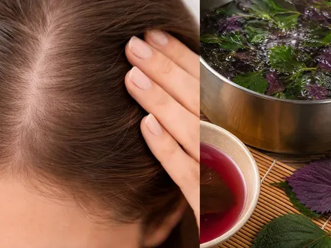 Cách gội đầu bằng nước lá tía tô hỗ trợ giúp da đầu sạch hơn, tóc bớt gãy rụng, mọc nhiều tóc mới